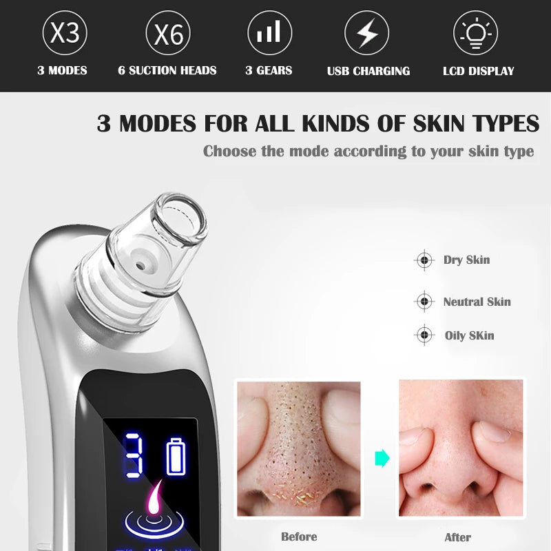 Premium Blackhead Remover - 6 Heads & LCD Display