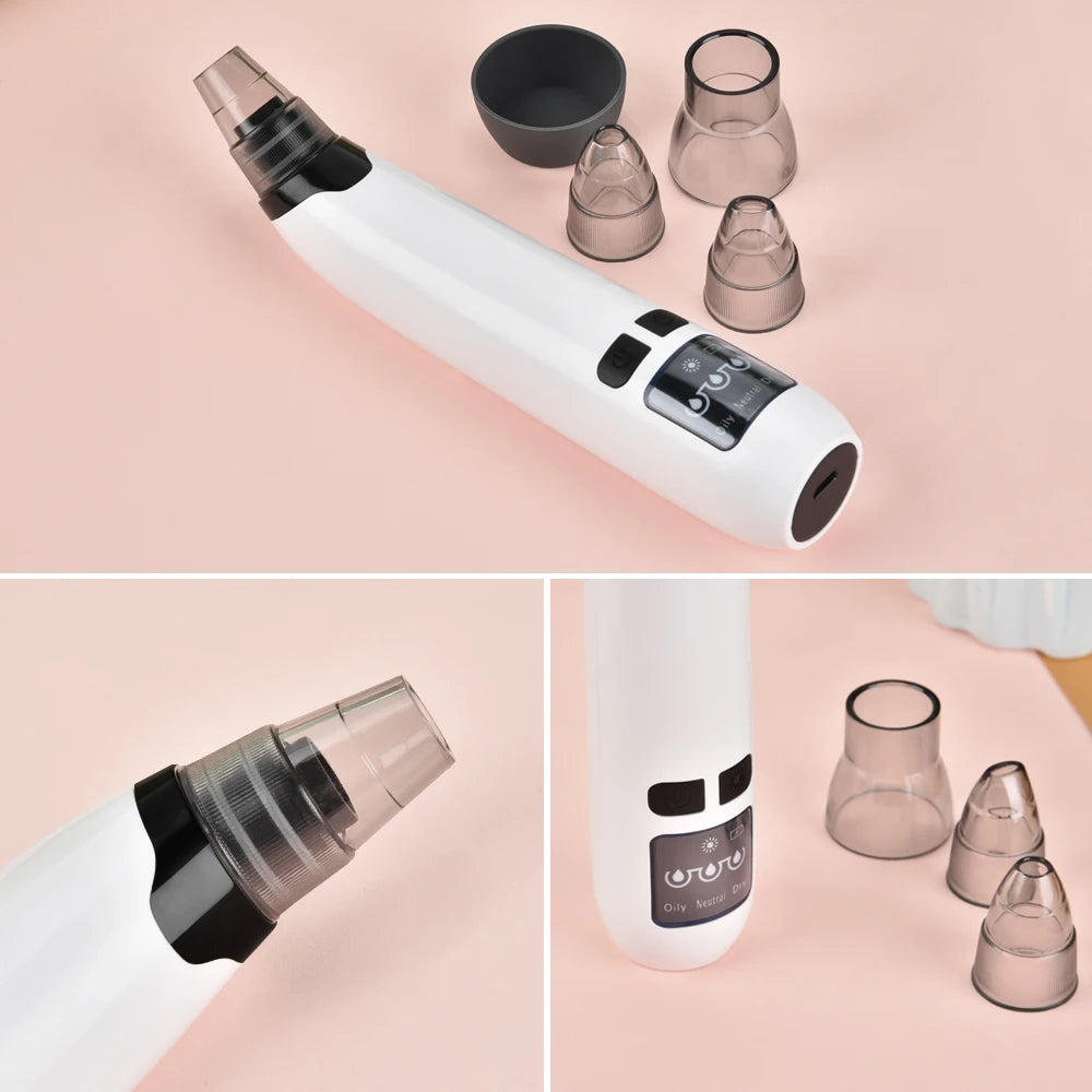 Electric Blackhead Remover - USB Rechargeable Pore Vacuum