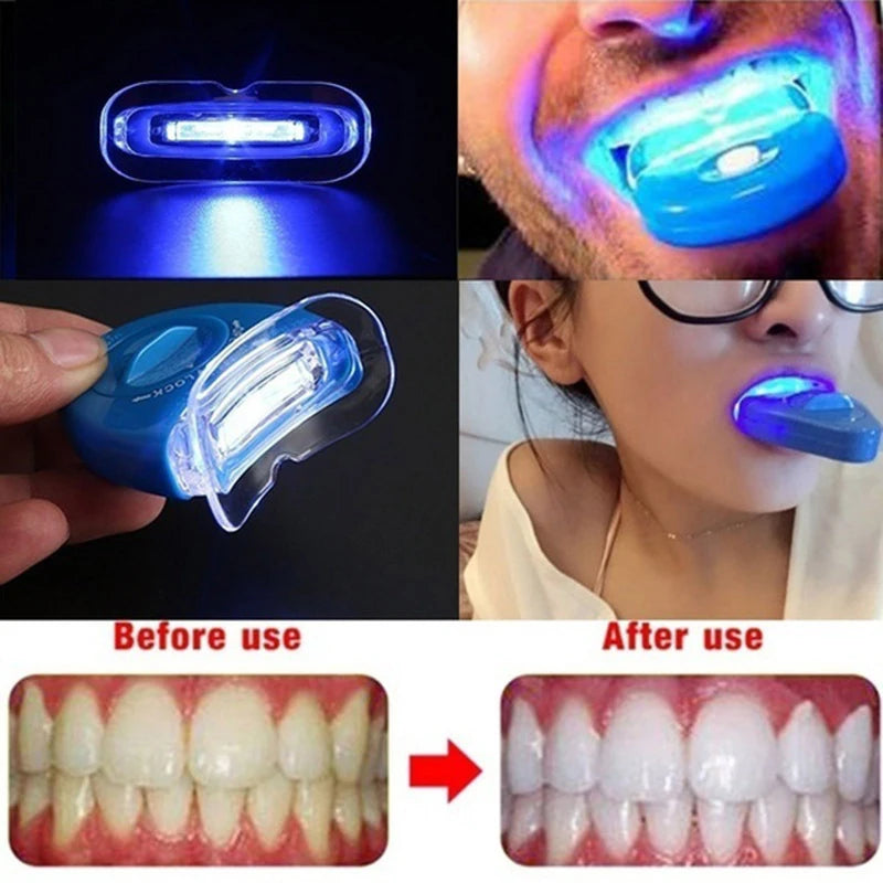 Teeth Light LED Blue Light Whitening Kit Teeth beauty Machine Utilizes Cold Light Technology Personal Dentals Treatments ﻿