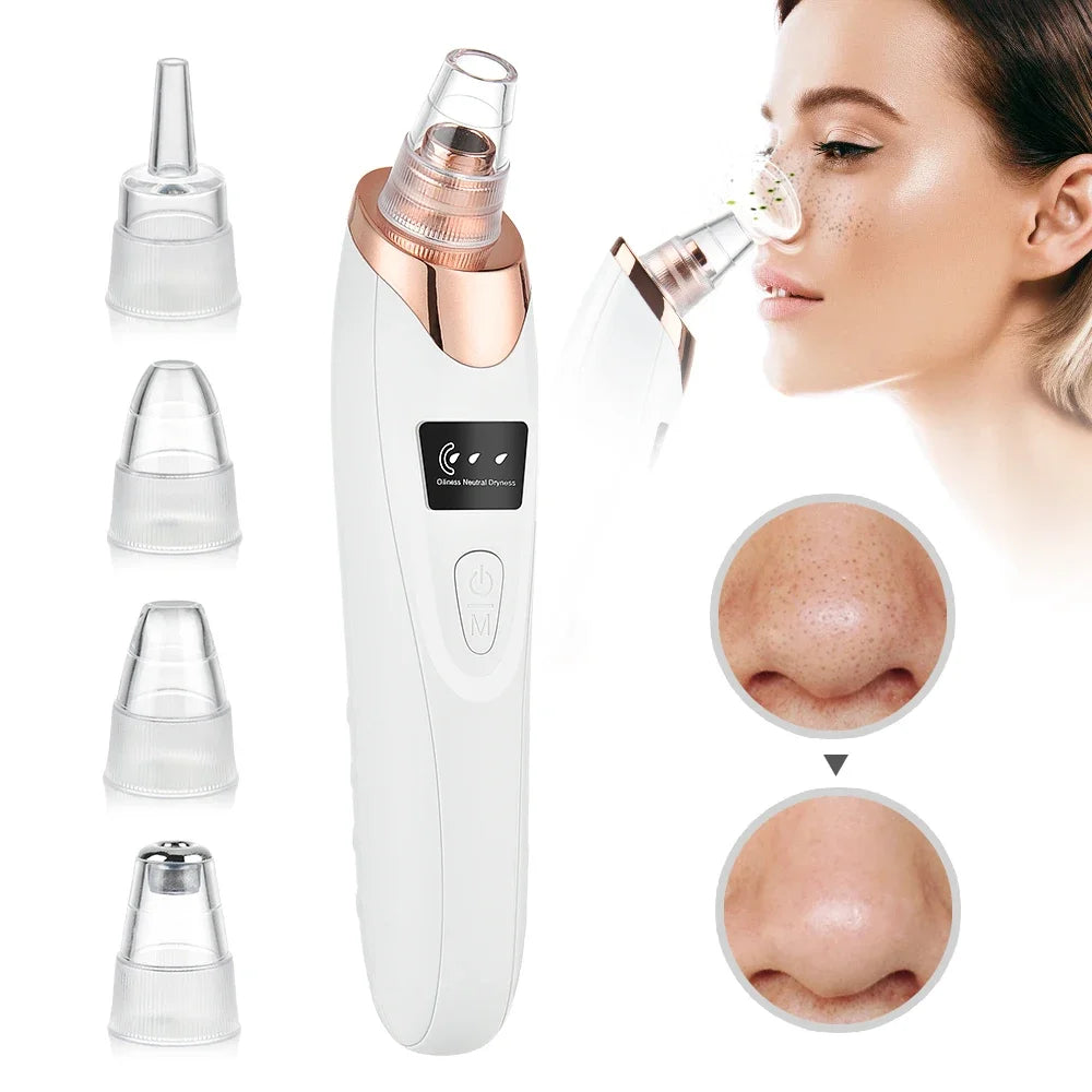 Blackhead Remover - 5 Heads Deep Cleansing Pore Vacuum