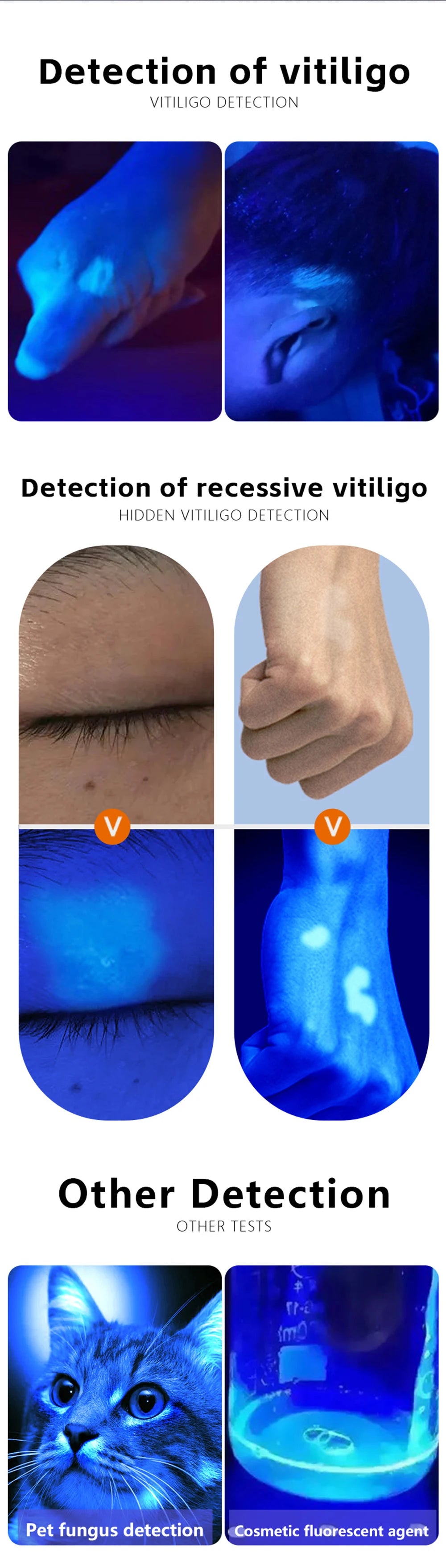 Woods Lamp Skin Analyzer