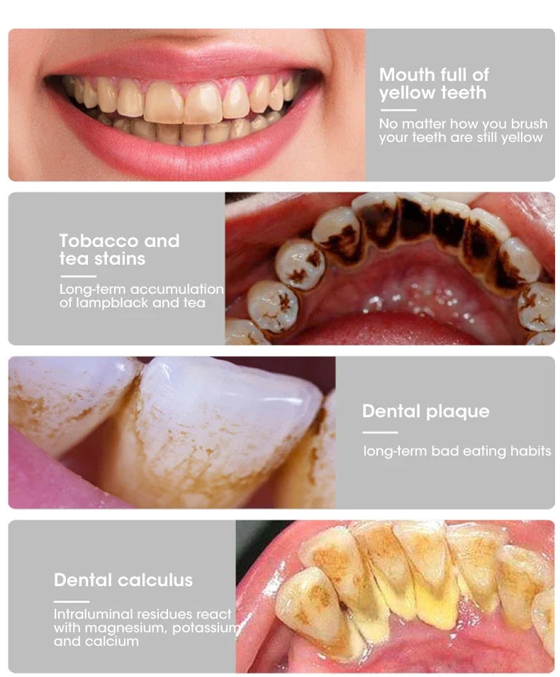 3 IN 1 Toothbrush Sonic Dental Teeth Whitening Kit Tooth Whitener Calculus Tartar Remover Tools Cleaner Stain Oral Care