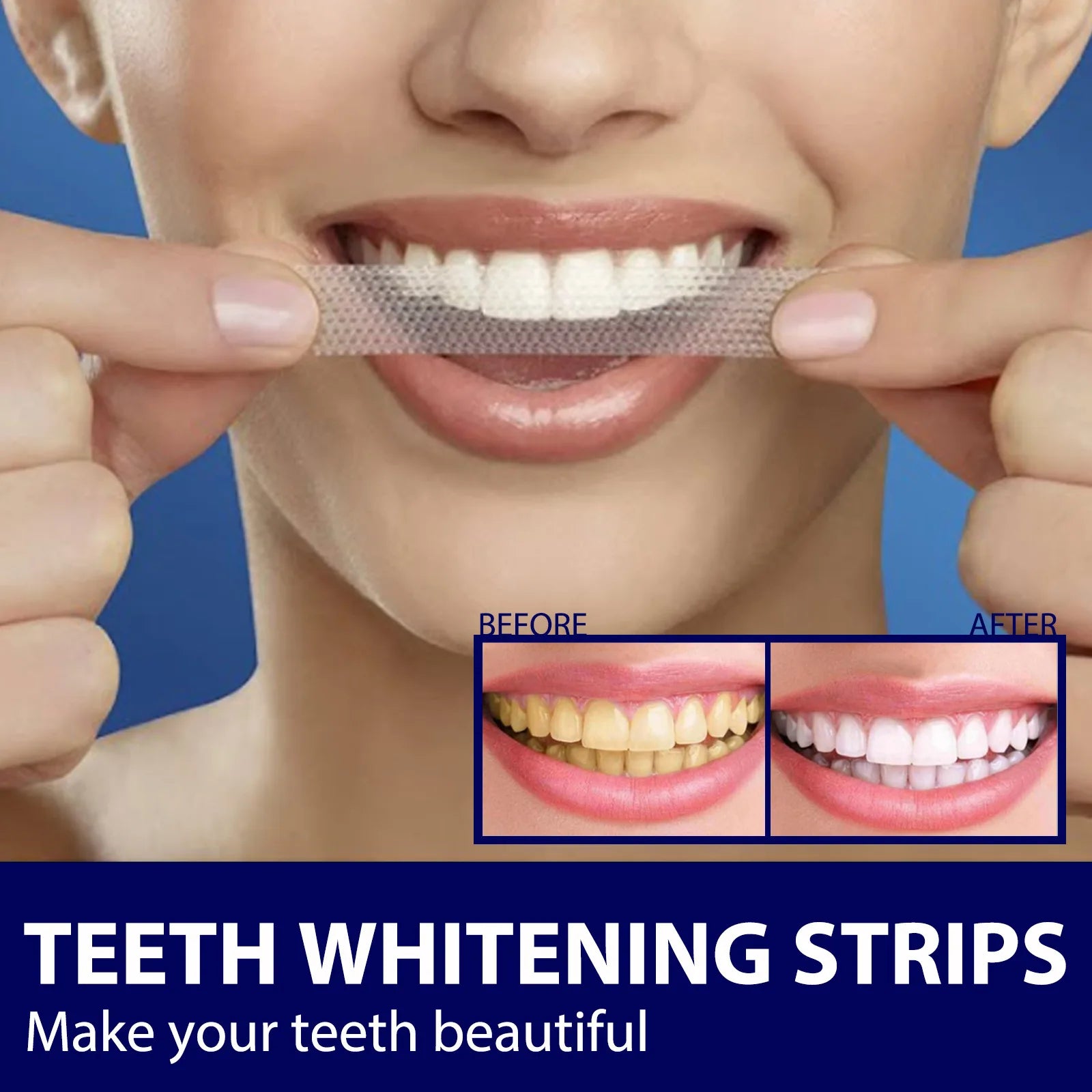 Teeth Whitening Strips - Mint Flavor White Gel