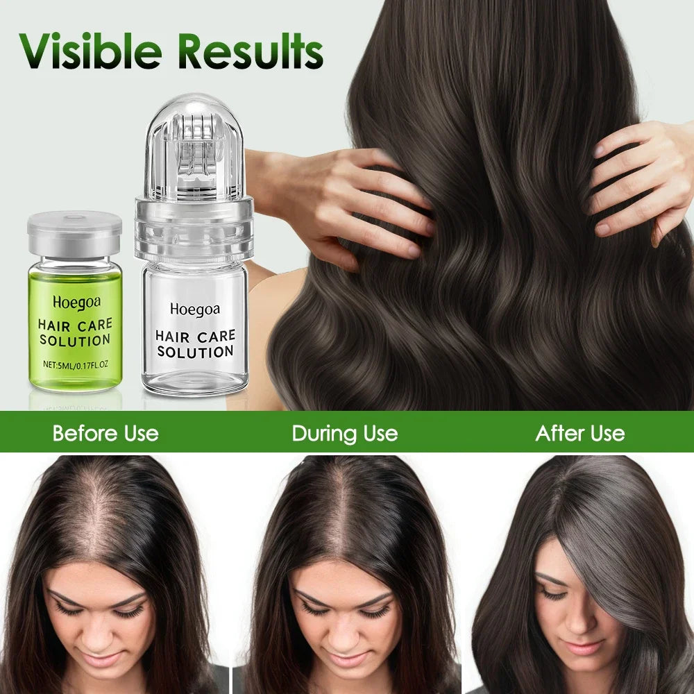 Anti-Hair Loss Scalp Serum Kit