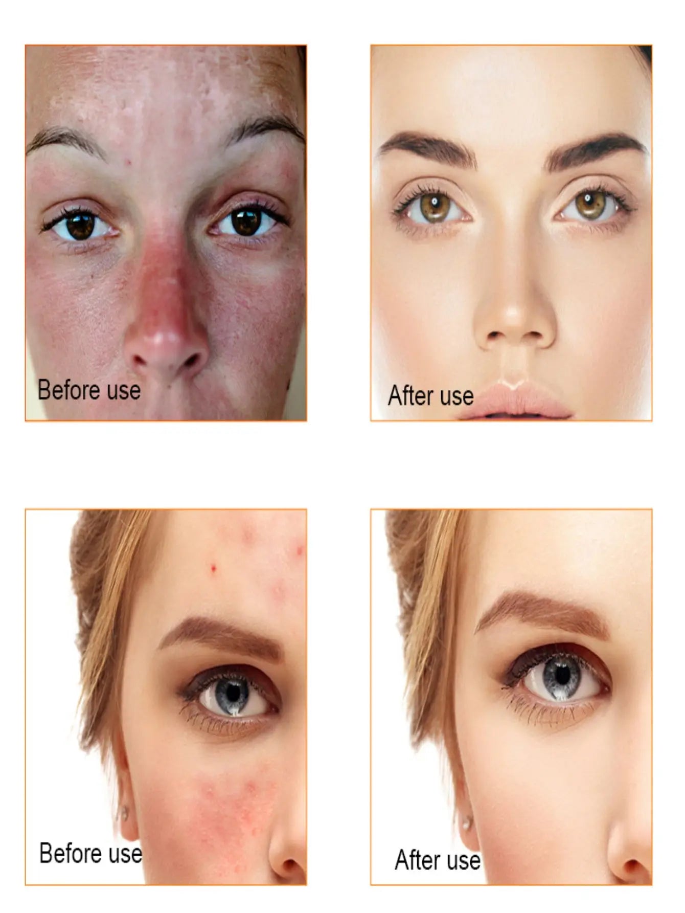 TRSTAY Vitamin C Brightening Serum - Moisturizing Face Treatment