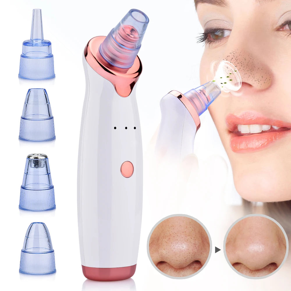 Multifunction Blackhead Remover - 5 Probes Acne Suction Tool