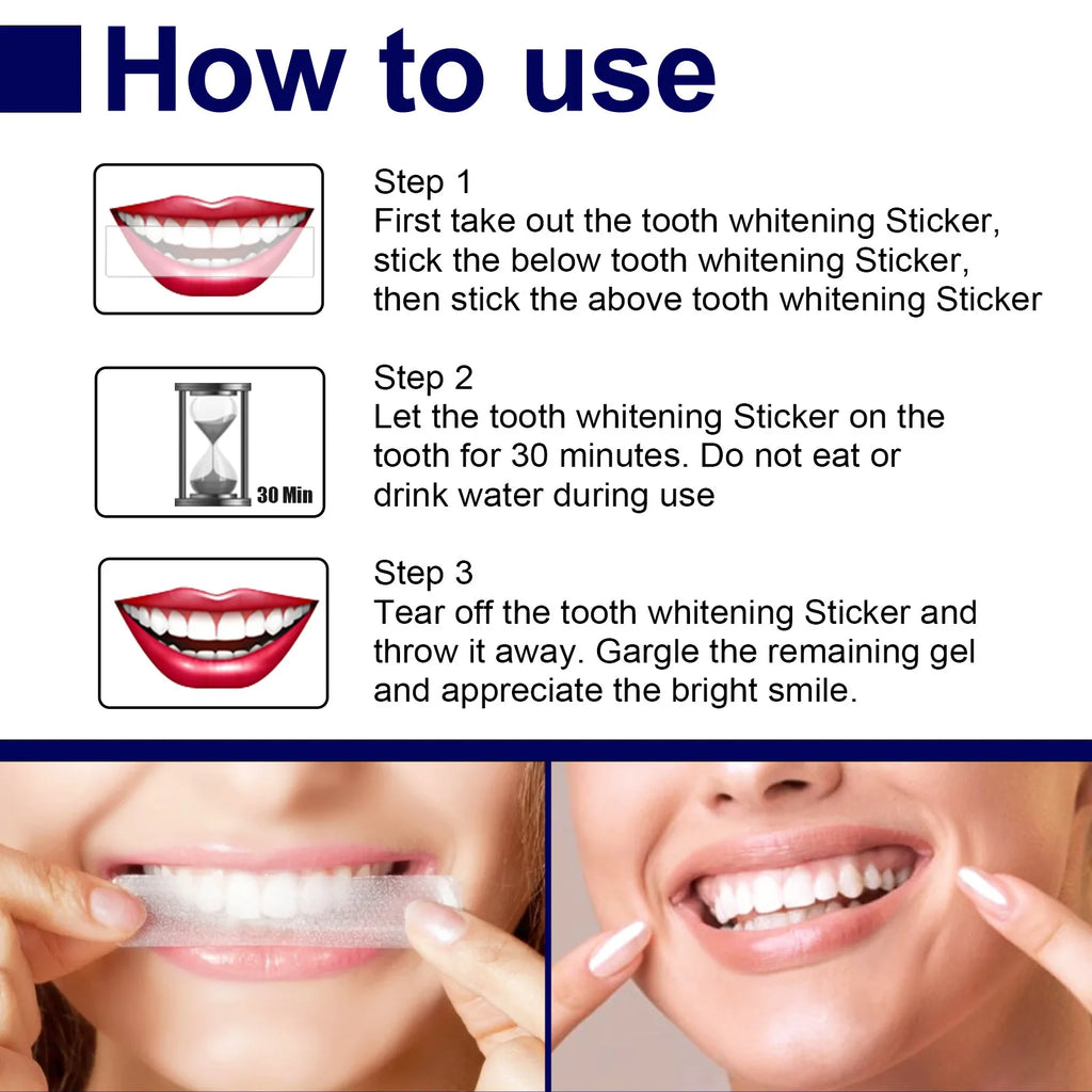 Teeth Whitening Strips - Mint Flavor White Gel