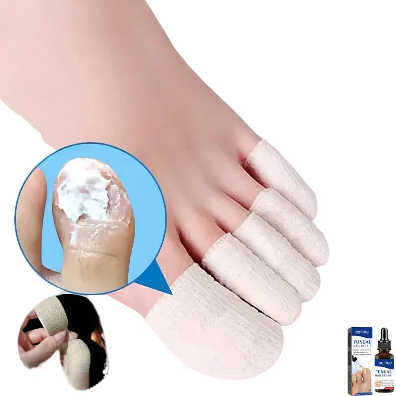 Pansements protecteurs pour ongles - Pansements auto-adhésifs pour orteils et doigts