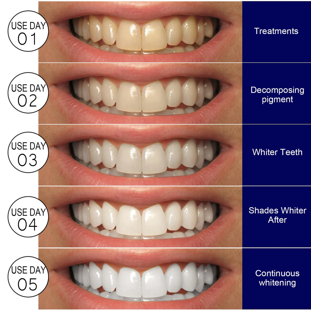 Teeth Whitening Strips - Mint Flavor White Gel