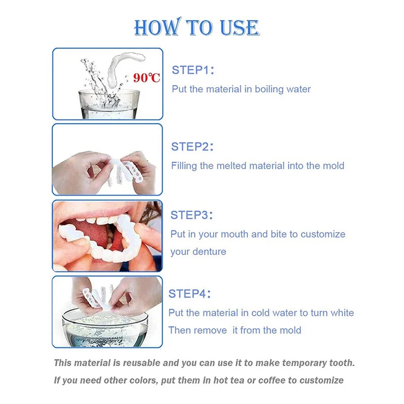 Snap-On Veneers - Temporary Tooth Whitening Kit