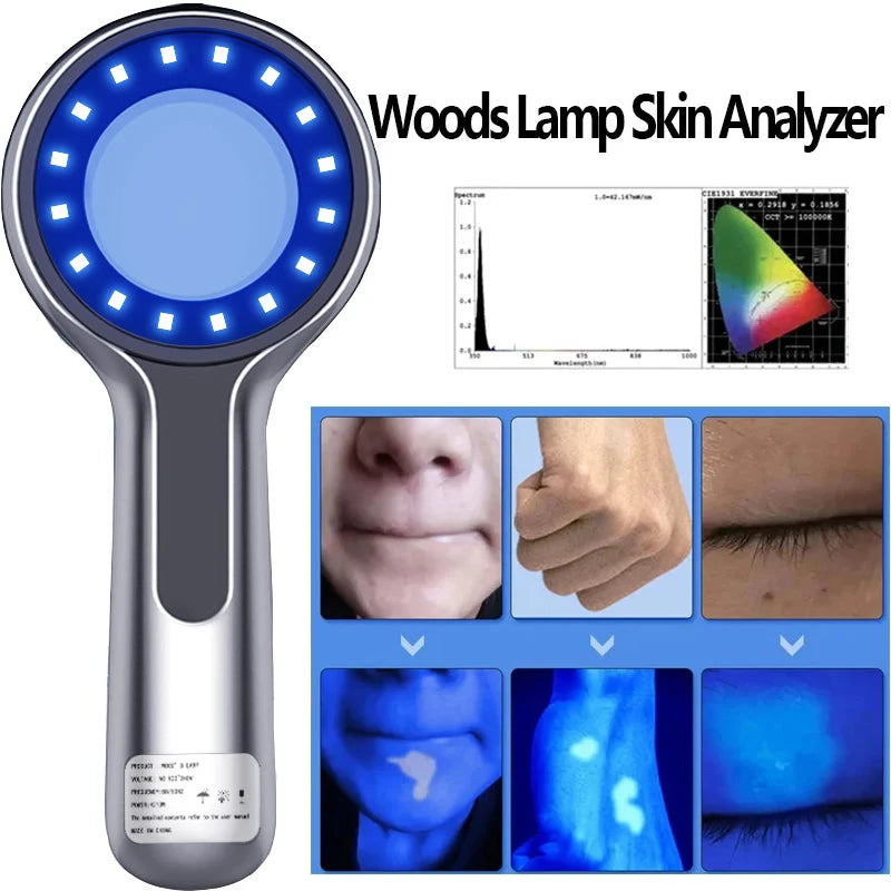 Woods Lamp Skin Analyzer