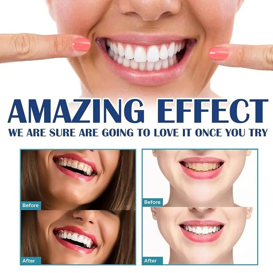 Teeth Whitening Strips - Mint Flavor White Gel
