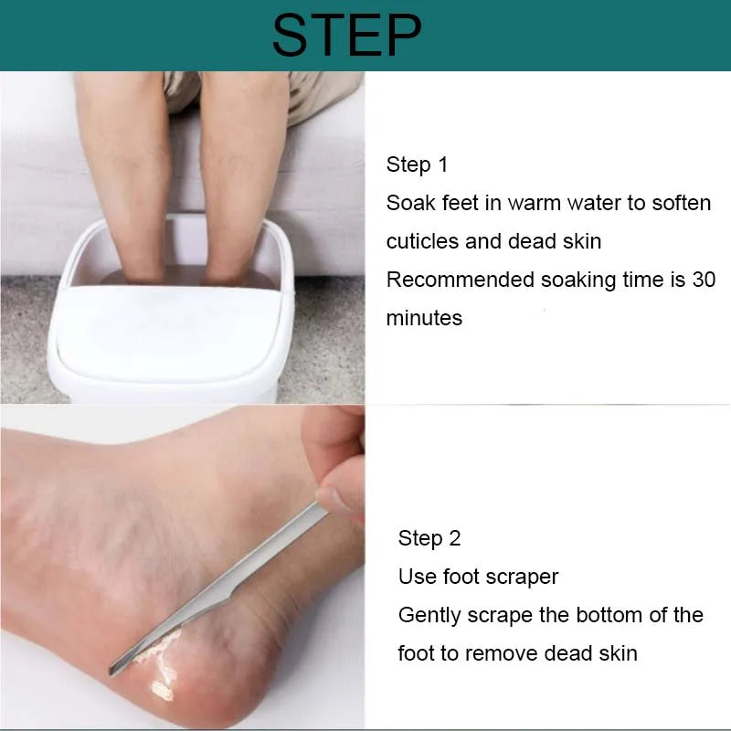 Professional Pedicure Foot Care Kit - Callus Remover & Dead Skin Tool Set